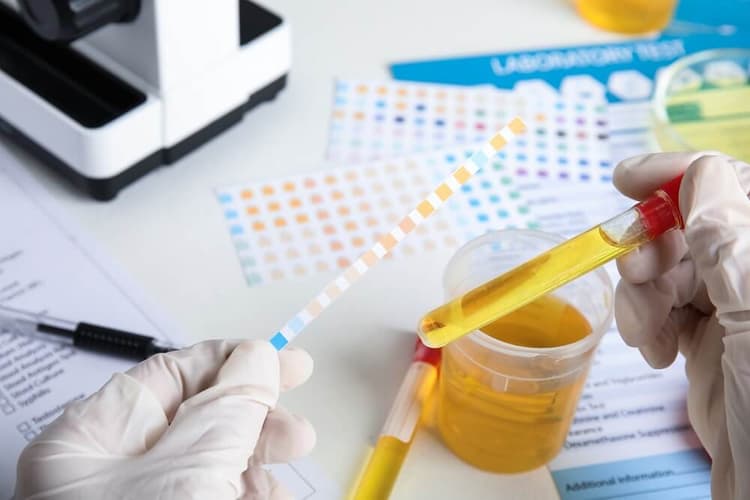 How to Read Urine Test Strips: A Comprehensive Guide for Healthcare Professionals and Caregivers - Featured blog post image for LFA First Response